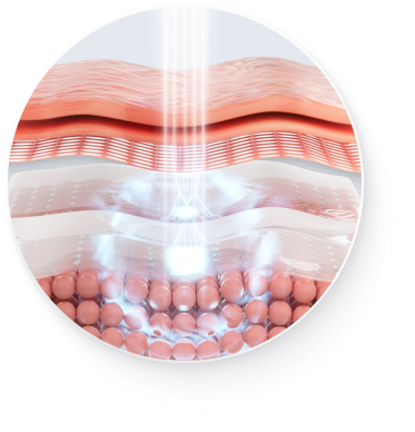 Hình minh họa cơ chế tái tạo collagen của Coolfase