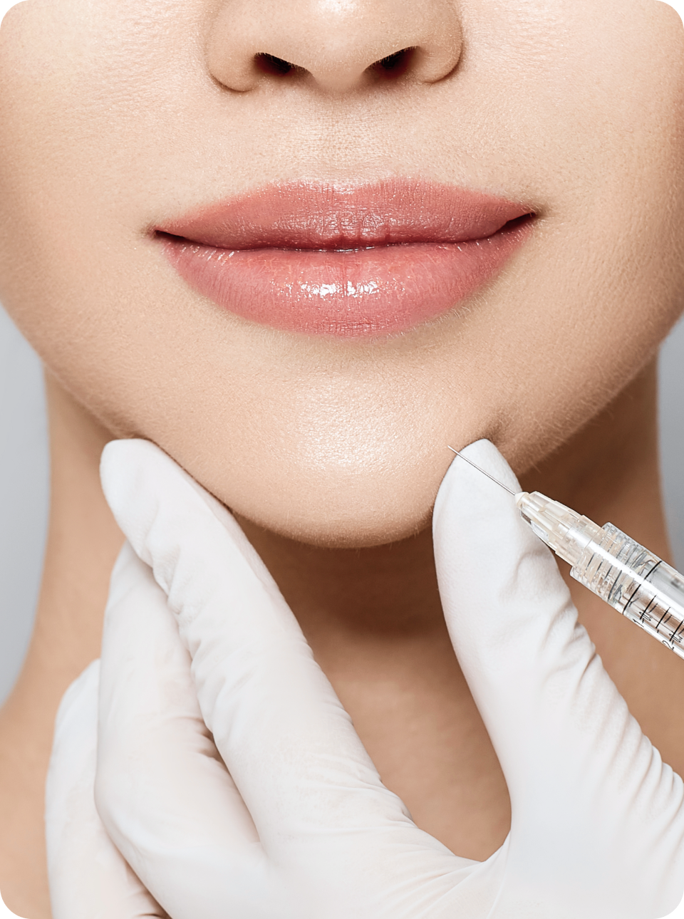 Hình ảnh quá trình điều trị Personal Filler LIENJANG phiên bản di động